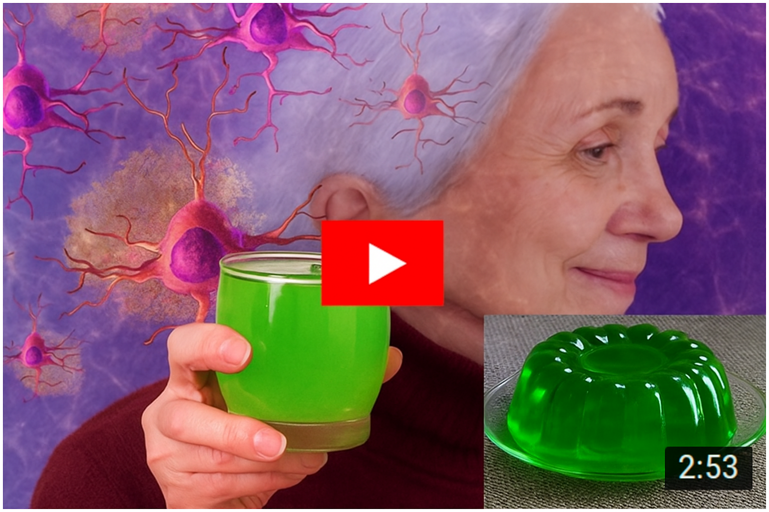 The gelatin method